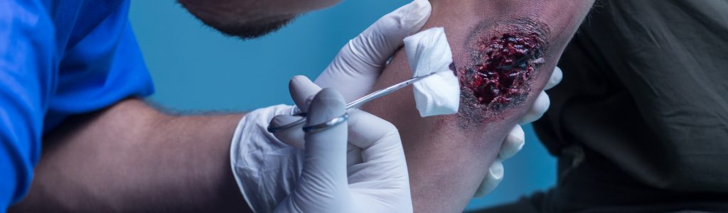 wound cleaning principles